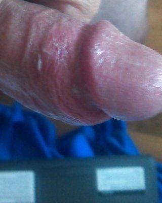 Cumm Abzudeckenden Hahn #6623032