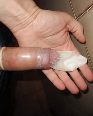 Cumshot On Condom Afetr 15 Days