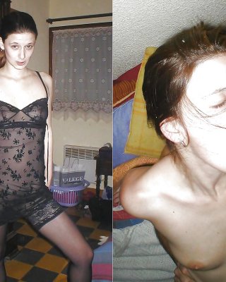 Vor Und Nach 6 #5229928