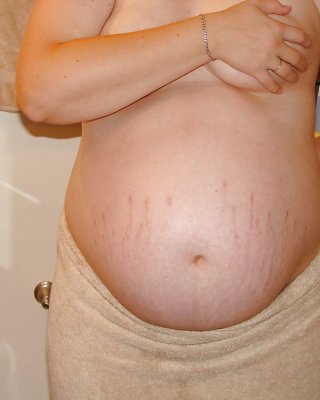 Schwangere Frau #5877818