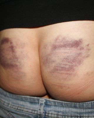Hintern Schaden Für Einen Guten Spank #7861477