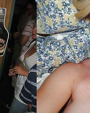 Vor Und Nach Der Mitten Ins Gesicht #18583479