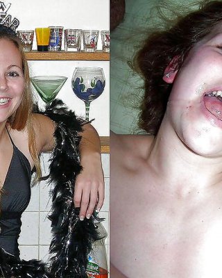 Vor Und Nach Der Mitten Ins Gesicht #18583662