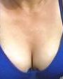 GILFs pix #1107384