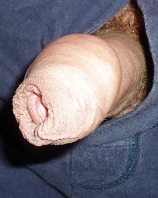 Penis With Foreskin