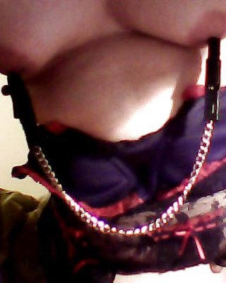 Nippelklemmen Mm #6600318