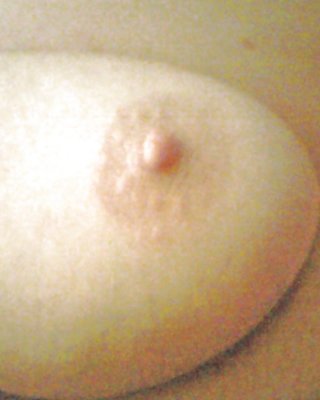 Spritzen Bbw #2755842