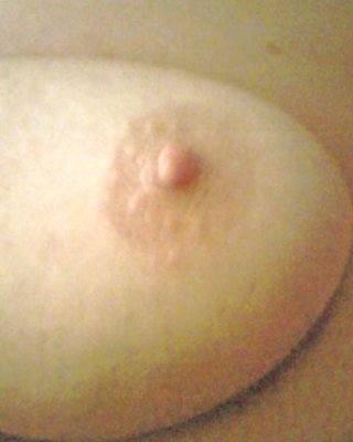 Spritzen Bbw #2755866