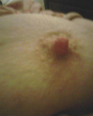 Spritzen Bbw #2755890