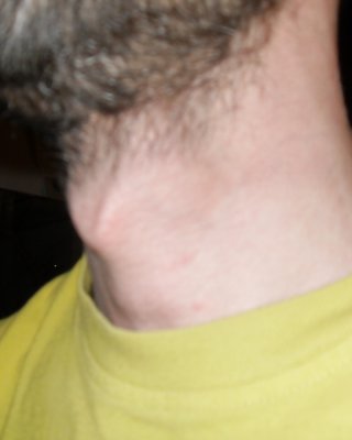私のkehlkopf will eine muschi 
 #15646421