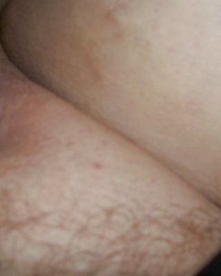 Verbreiten Ein #11357091