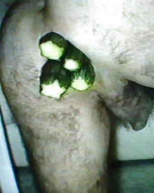 Anal Insertion (male)