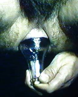 Anal Insertion (male)