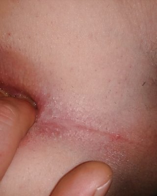 Tapado
 #22443610