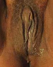 Schön Dick #15111802