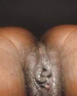 Schön Dick #15111829