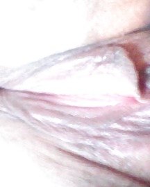 ON THE DL #14847416