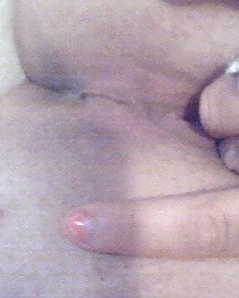 ON THE DL #14847473