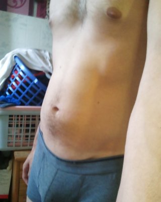 My Second Belly Inflation With 2.5L Of Water