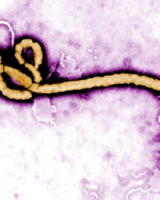Xenex Wenig Moe: Töten Ebola Und Andere Krankheitserreger In Nur Wenigen Minuten. #29769109