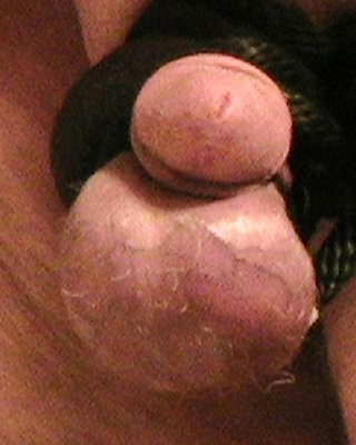 Cbt #30711625