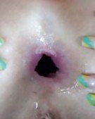 Anal Gape Bilder #25540608