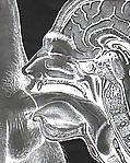 Huge cock xray #25087717
