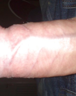Me Nk #33224140