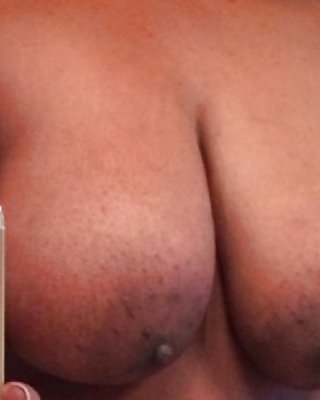 Große Schwarze Areolas Teil 34 #39604136