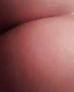 Mädchen Von 18 Jahren Der Vogesen #24916205