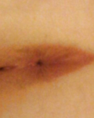 X Me X #35765486