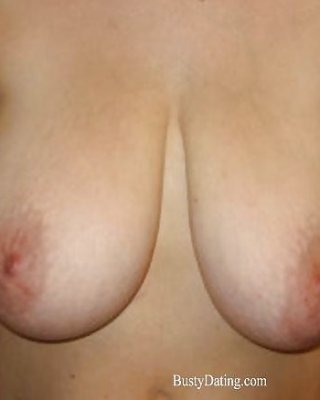 Vollbusige Brustverkleinerungen - Set 09 #36405459