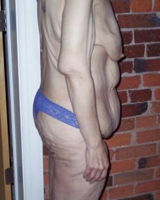 ältere Vulva über 60 #41108204