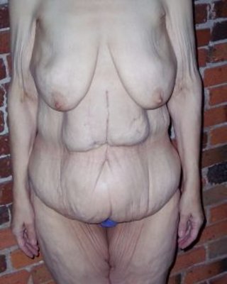 ältere Vulva über 60 #41108209