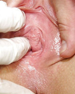 Close up Arzt Überprüfung eines formidable babe alexa fett mit Gyno Titten
 #51007310
