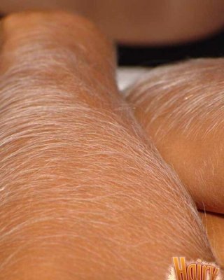 Nahaufnahme von Loris sexy Armhaar
 #67427384