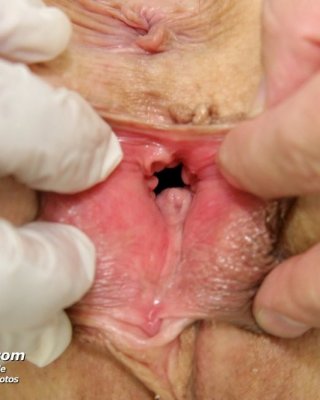 Old Mila pussy gyno fetish doctor gyno exam at clinic #76386409