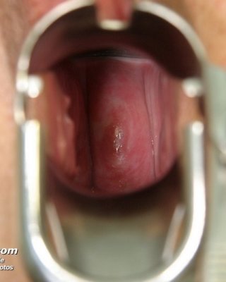 Old Mila pussy gyno fetish doctor gyno exam at clinic #76386444
