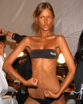 Skinny magersüchtige Mädchen posieren und in Aktion
 #78733246