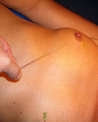 Mature Needle Torture And Breast Skewering Punishment Of German Slavegirl Tri