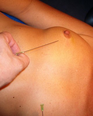 Mature Needle Torture And Breast Skewering Punishment Of German Slavegirl Tri