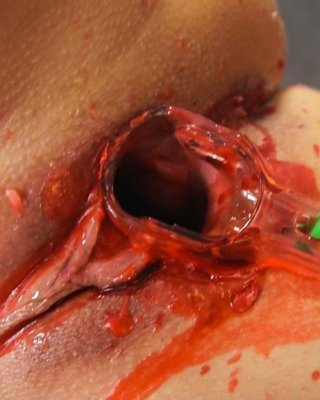 vagina Fully Filled With Hot Wax