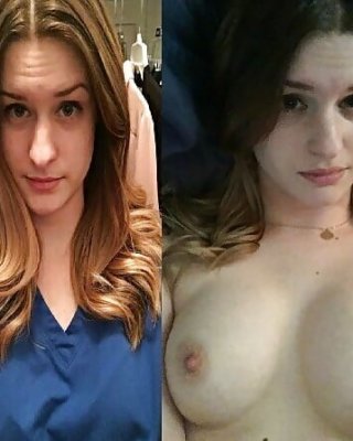 ビフォア・アフターの素晴らしいおっぱい 13
 #95539644