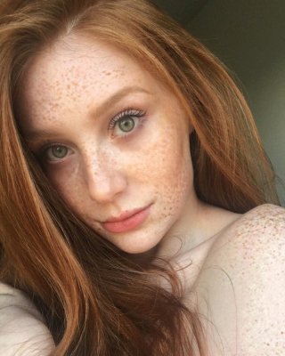 Freckled Faces