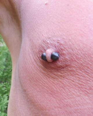 Mes tetons apres pompe a seins et pinces
 #79792691