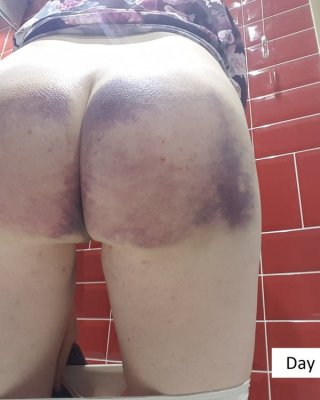 Bruised Ass From Spanking - Jenny Poussin Nude Porn Pics Leaked, XXX Sex Photos app.page 18 - PICTOA