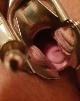 Seks ona va jiyani Katoliklarda jinsiy olatni sunnat qilingan