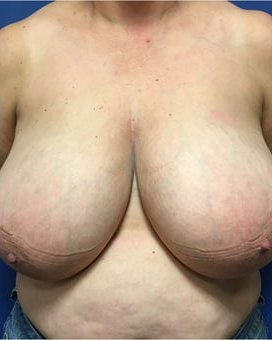 Great tits 18_24 #81897656